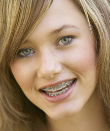 smiling teenage girl with braces
